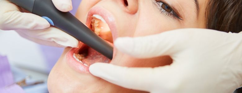 Root Canal Treatments