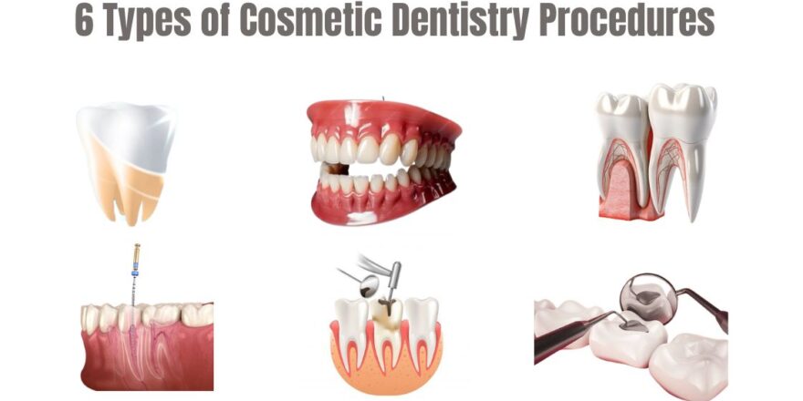 6 Types of Cosmetic Dentistry Procedures