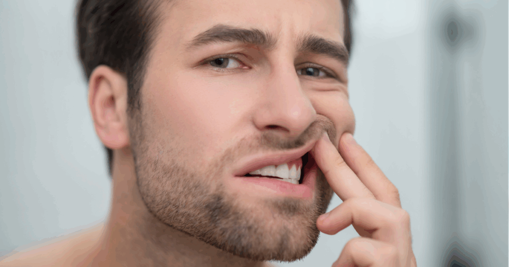 Red swollen gums showing early signs of gum disease