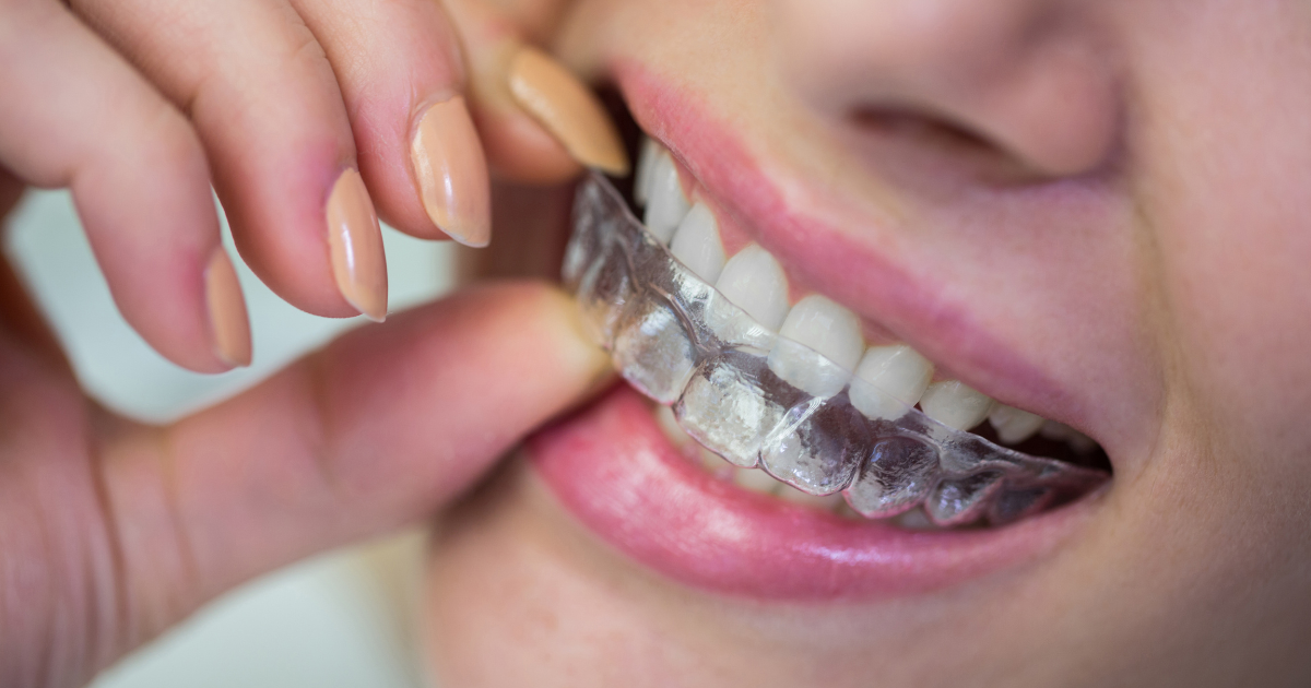 Retainer for correcting shifted teeth and maintaining alignment