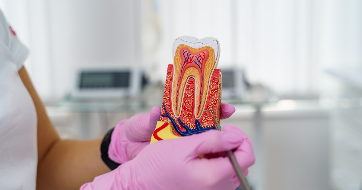 Close-up of dental tools used for Root Canal procedure