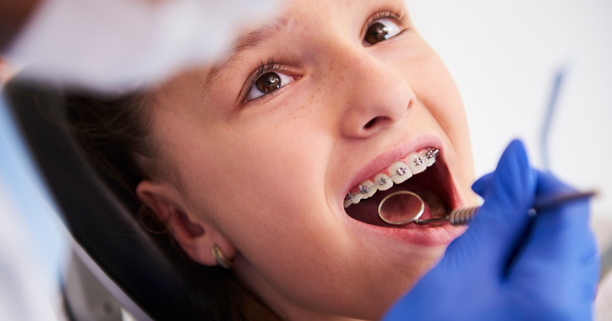 Dental braces on teeth with orthodontist explaining treatment phases