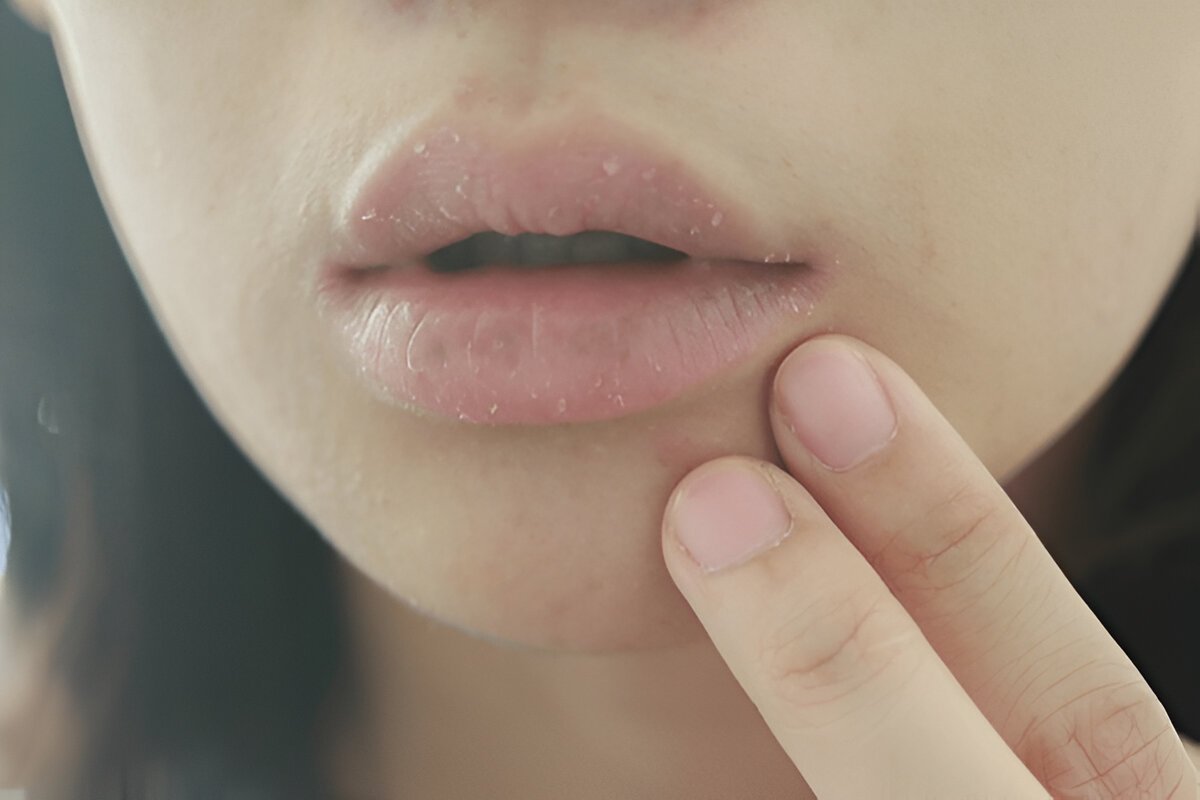 Low saliva causing dry mouth and affecting oral health