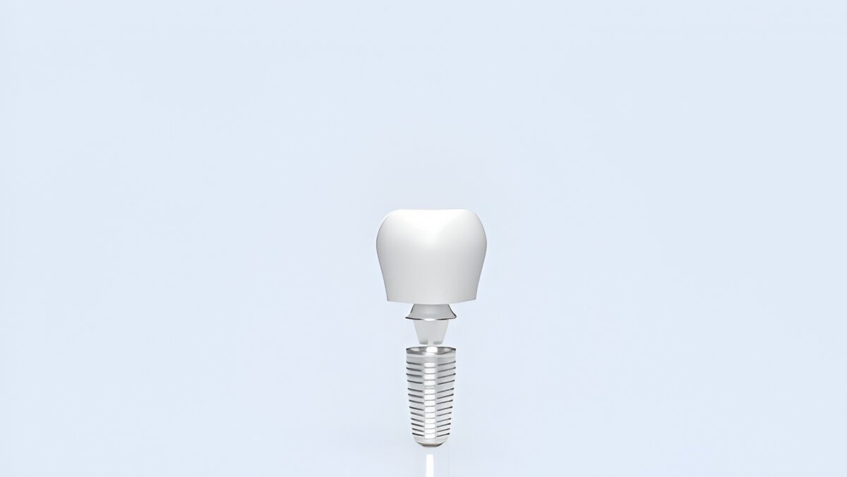 Biocompatible dental materials comparison for safe dental treatments